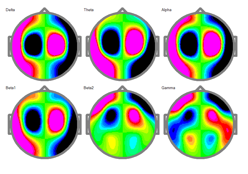 Colorful 2D heat maps showing brain activity in different regions.