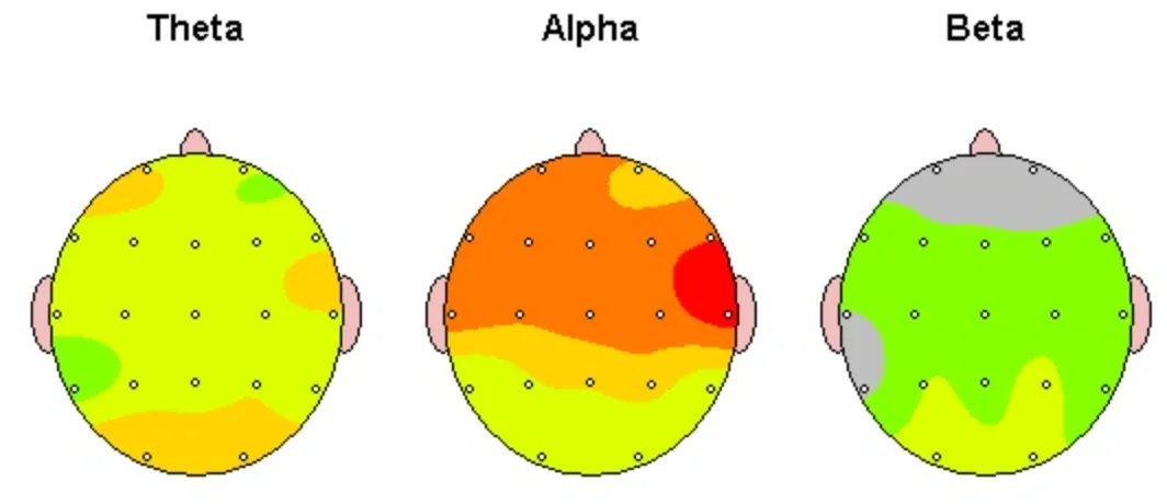 Brainwave activity maps: Theta, Alpha, Beta
