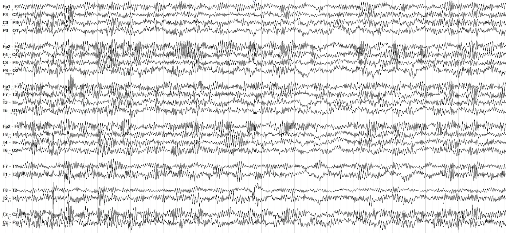 Electroencephalogram data display